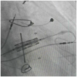 POs0OwrjLVPlHDyP.png image.png