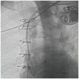 b42cs3hAG9RLkyAv.png image.png