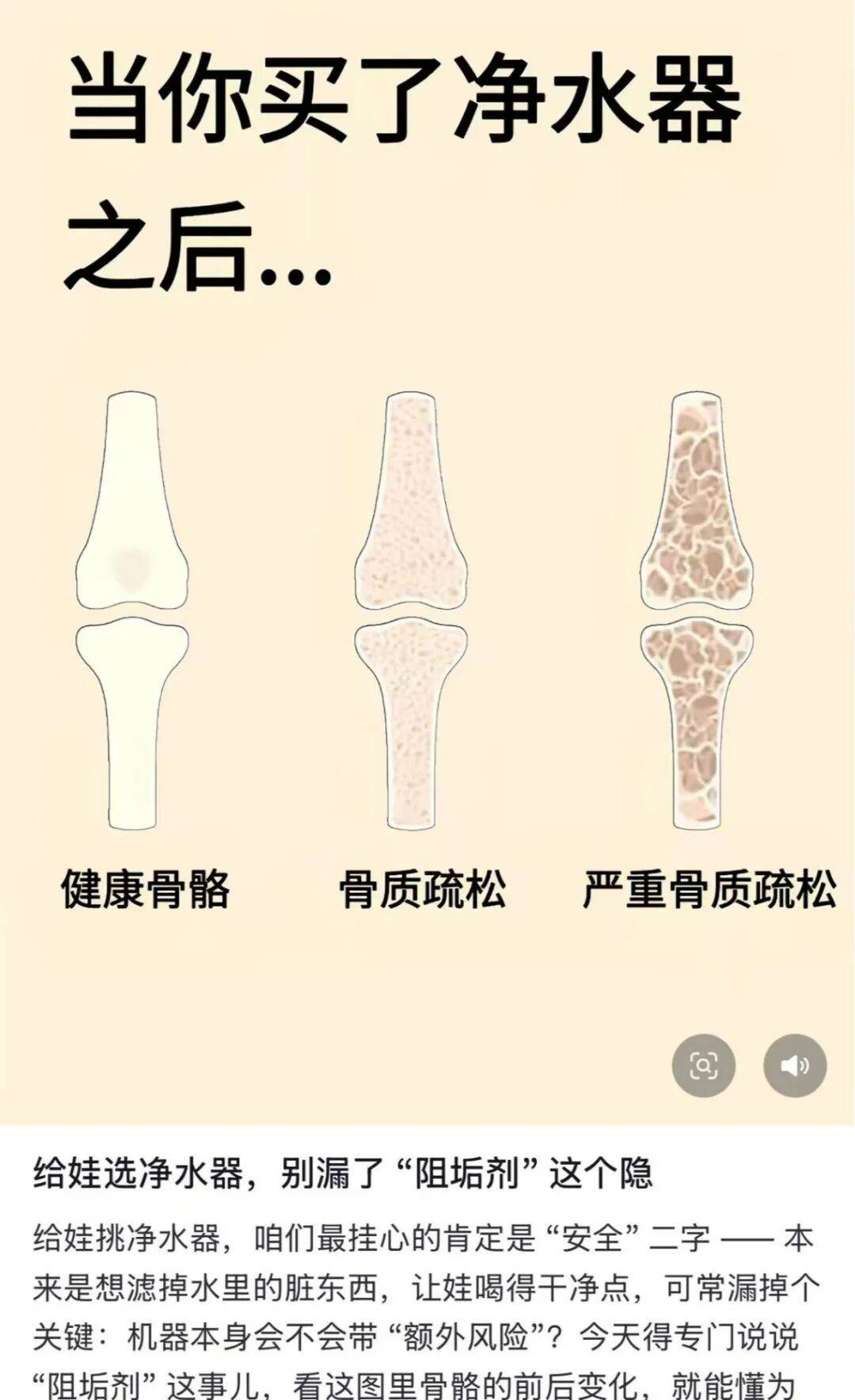 网传“净水器中加入阻垢剂会得骨质疏松”，是真的吗？记者调查 (图3)