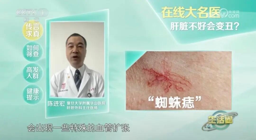 这种面相可能是肿瘤前兆!别以为只是“发福”了(图3)