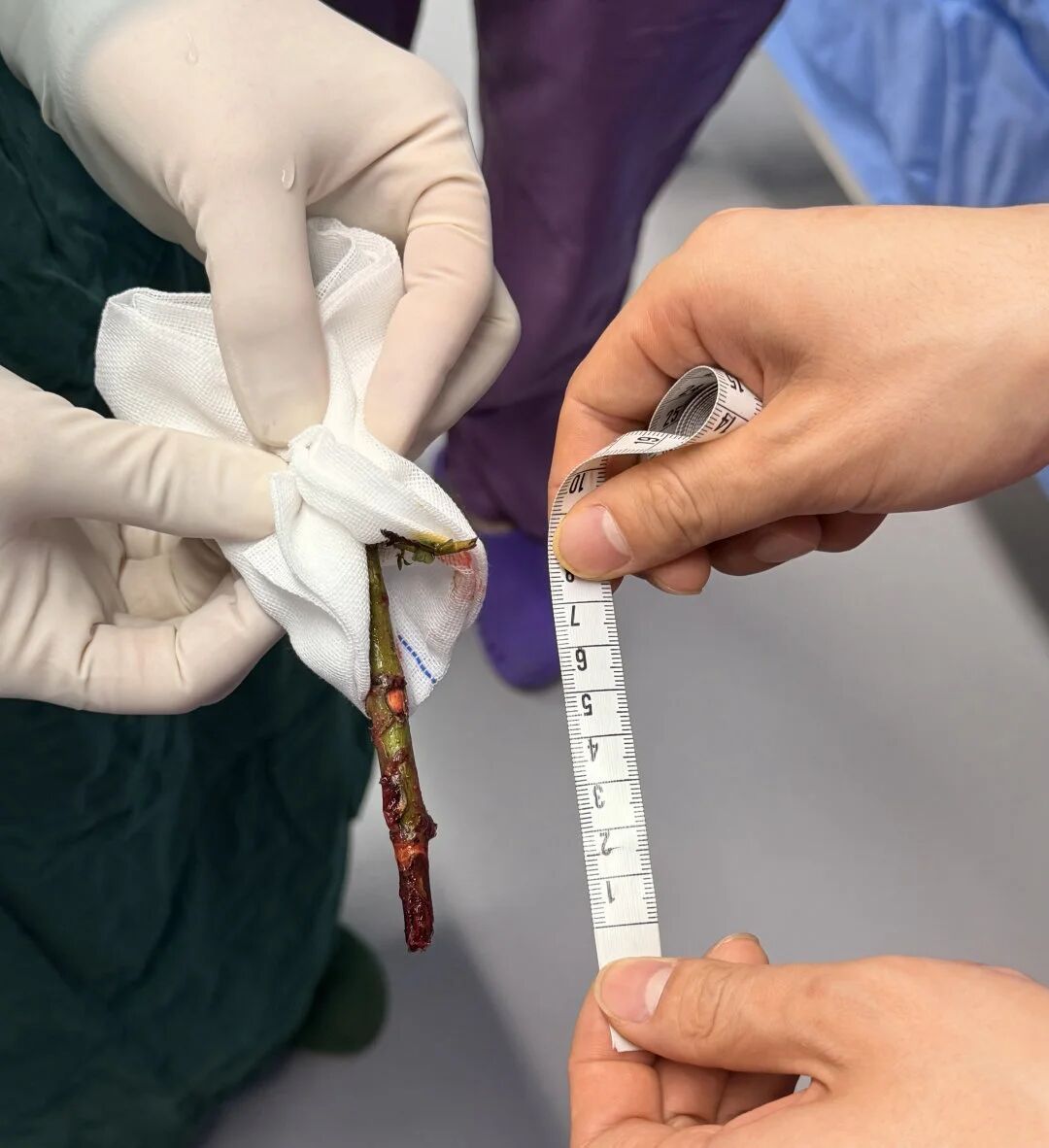 16岁少年眼眶插入8厘米树枝 医院多学科团队接力救治转危为安(图3)